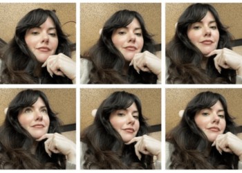 Botox Review: I’m Answering 12 Frequently Asked Questions I Get About Botox | Wit & Delight