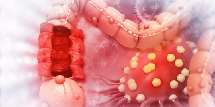 Scientists Discover Molecule That Heals Intestines and Combats Cancer Growth