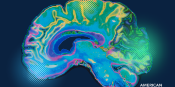 American Brain Foundation Launches $10M Neuroinflammation Research Initiative –