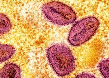 Mpox: More cases of new Clade 1b strain detected in UK | UK News