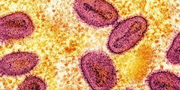 Mpox: More cases of new Clade 1b strain detected in UK | UK News