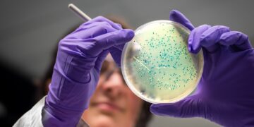 ‘Disease-causing’ salmonella could actually help combat bowel cancer, study suggests | Science, Climate & Tech News