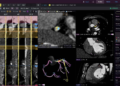Cleerly Secures $106M to Advance AI-Powered Cardiac Care