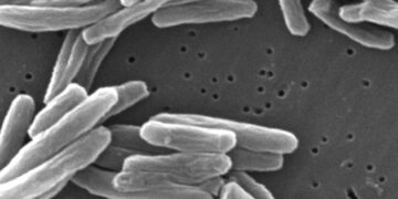 Kansas Health Officials Are Battling An ‘Unprecedented’ Tuberculosis Outbreak