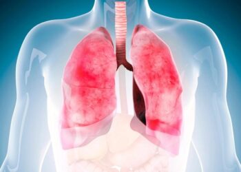 Common Cough Syrup Ingredient Could Treat a Serious Lung Disease