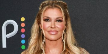 Dr. Terry Dubrow Performed 4 Biopsies to Heal Brandi Glanville’s Face 