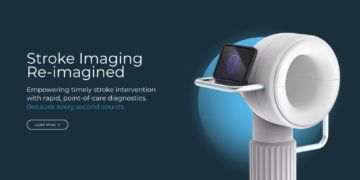 Wellumio Expands Stroke Detection Device to U.S. Market
