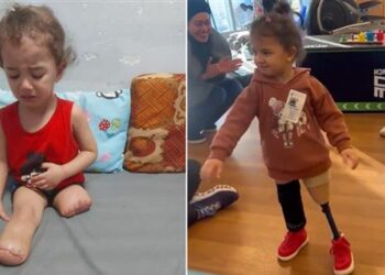 Gazan girl, 3, who lost both legs under Israeli bombardment walks again after receiving treatment in US | World News