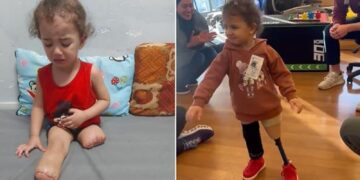 Gazan girl, 3, who lost both legs under Israeli bombardment walks again after receiving treatment in US | World News