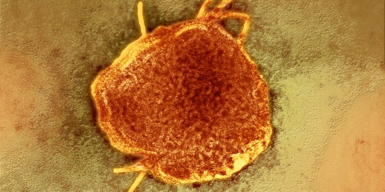 Measles Outbreak Hits Town in Texas