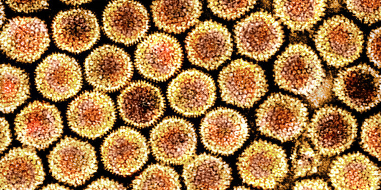 Trillions of Viruses Live in Your Body. A.I. Is Trying to Find Them.