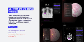 Harrison.ai Secures $112M to Expand AI-Powered Medical Diagnostics