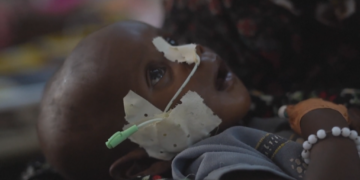 Nutrition for Growth summit: Leaders call for solidarity amid funding crisis