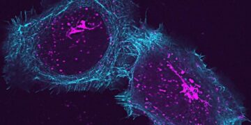 Scientists Uncover Hidden Protein Driving Autoimmune Attacks