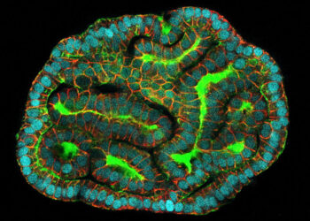 Scientists can help fetuses by growing tiny replicas of their organs