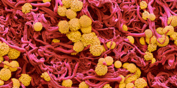 Lethal fungi are becoming drug-resistant—and spreading