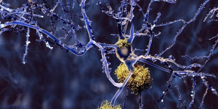 AI Unlocks Long-Standing Biomedical Mystery Behind Alzheimer’s