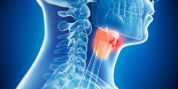 Mayo Clinic Doctor Reveals 3 Simple Ways To Reduce Your Risk of Head and Neck Cancer