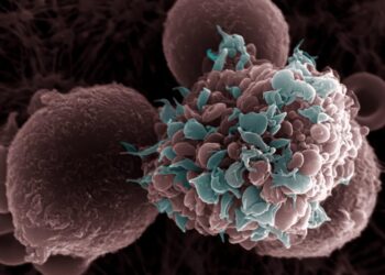 How Obesity Fuels the Spread of Breast Cancer: New Study Reveals Alarming Link