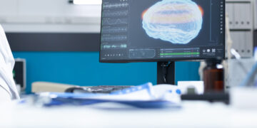 How Are Advances in Neurologic Technology Changing Diagnosis and Treatment?