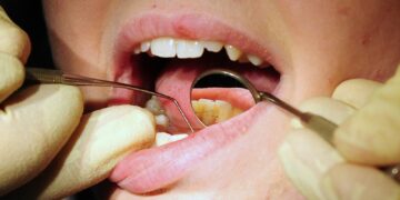 Scheme to boost access to NHS dentists ‘comprehensively failed’, MPs say | Politics News