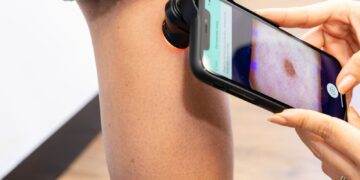 Skin cancer detection firm lands £15m to fund growth plans | Money News