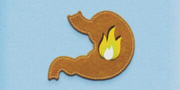 Why Heartburn Is More Common As You Get Older