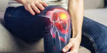 Your Knees Might Be Aging Faster Than You Think