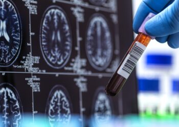 First FDA-cleared Alzheimer’s blood test set to boost diagnoses’ speed, accuracy : Shots