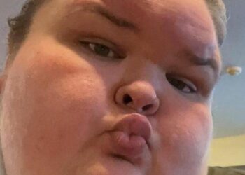 Tammy Slaton’s Video Of Excess Skin Surgery Result Stuns Fans