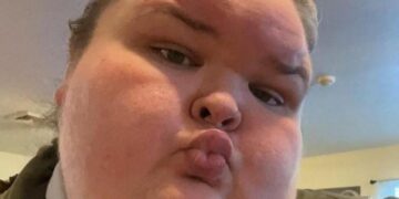 Tammy Slaton’s Video Of Excess Skin Surgery Result Stuns Fans