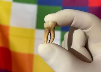 Ancient DNA Reveals Leprosy Was in America Centuries Before Columbus