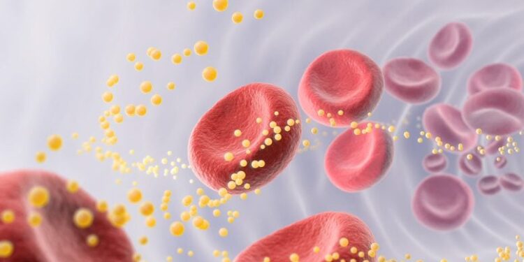 Atherosclerosis Shows Tumor-Like Cell Growth, Surprising Scientists