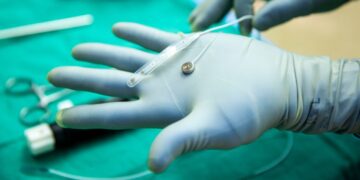 A Neuralink Rival Just Tested a Brain Implant in a Person