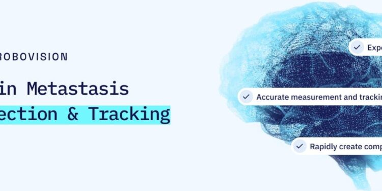 AI Detects Brain Tumors Smaller Than a Grain of Rice — With 97% Accuracy