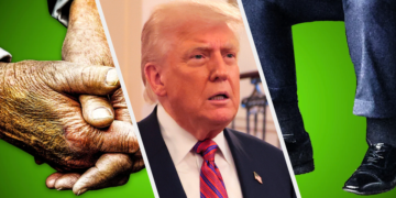 What Is Chronic Venous Insufficiency? Trump’s Condition, Explained.