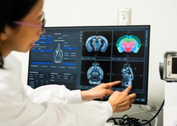 Brain Gains: Creatine’s Surprising Cognitive Benefits