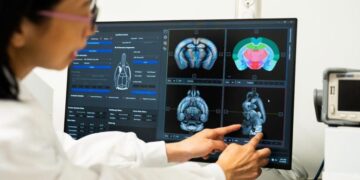 Brain Gains: Creatine’s Surprising Cognitive Benefits