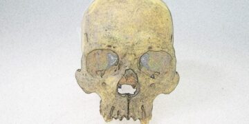 Before Columbus: A 4,000-Year-Old Skeleton Reveals a Rare Leprosy Strain in the Americas