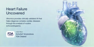 Ultromics Secures $55M to Expand AI-Driven Cardiology Solutions for Heart Failure