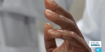 Nigerian firm revolutionises the world of prosthetics with bionic arms