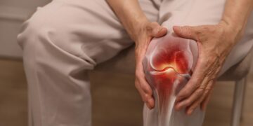 Why Most Knee X-Rays Do More Harm Than Good