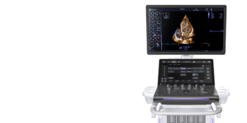 GE HealthCare Launches AI-Powered Cardiovascular Ultrasound System