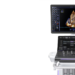 GE HealthCare Launches AI-Powered Cardiovascular Ultrasound System