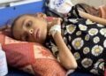 Every hospital in Gaza overwhelmed with malnutrition cases | World News