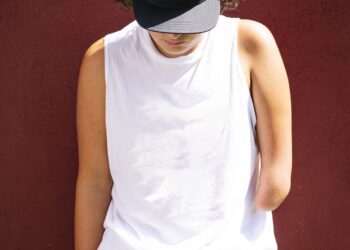 After an amputation, the brain remembers the body’s lost limb : Shots