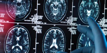 There Are 2 New Dementia Risk Factors You Should Know About