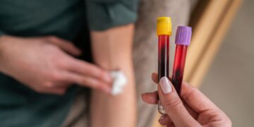 New blood test for more than 50 cancers ‘could transform outcomes’ | Science, Climate & Tech News
