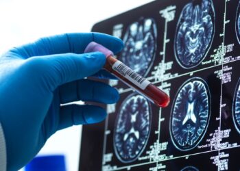 Blood Tests for Alzheimer’s Are Here