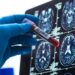 Blood Tests for Alzheimer’s Are Here